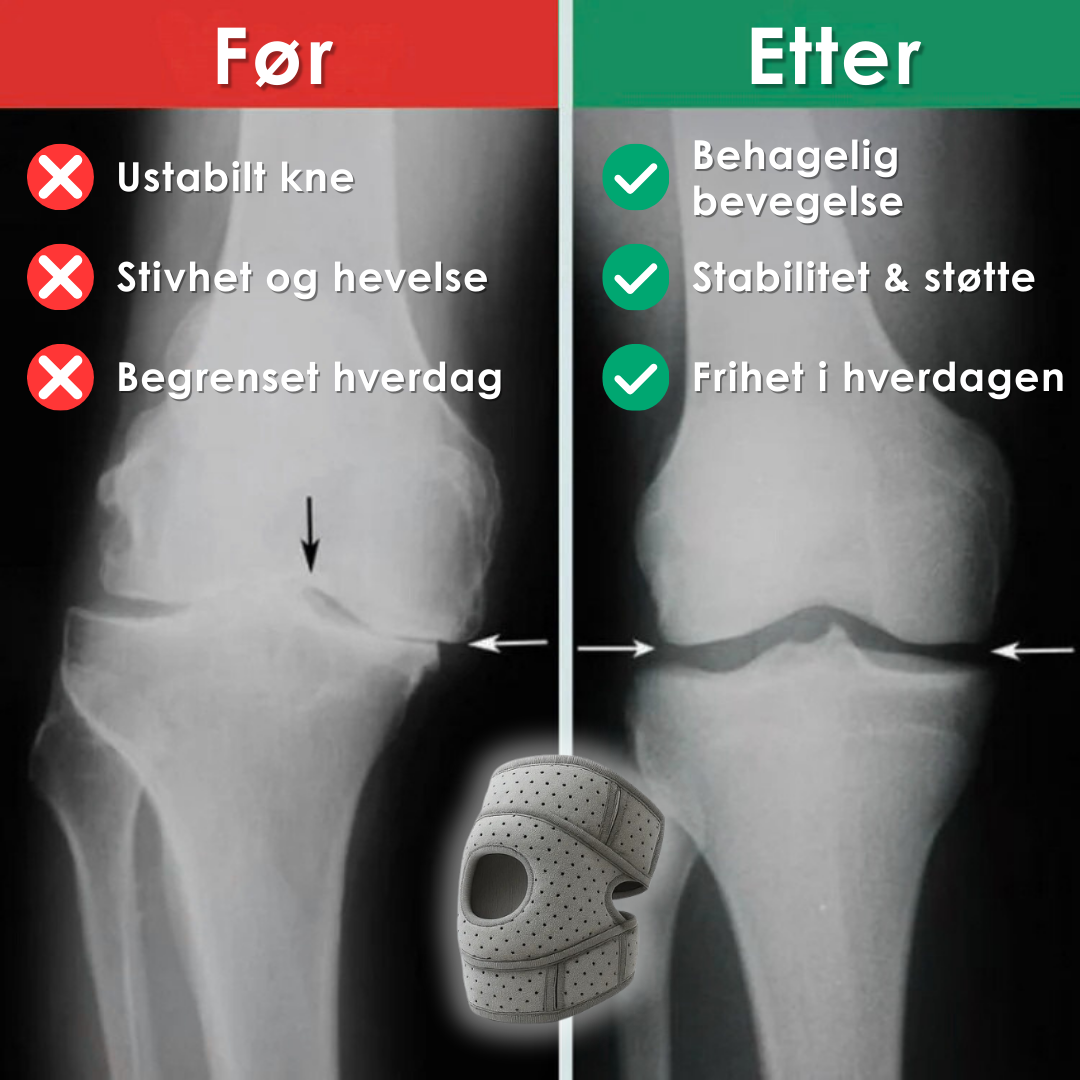 OrthoKnee Pro™ – For en hverdag uten knesmerter